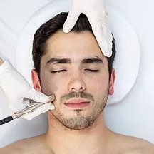 micro-treatment